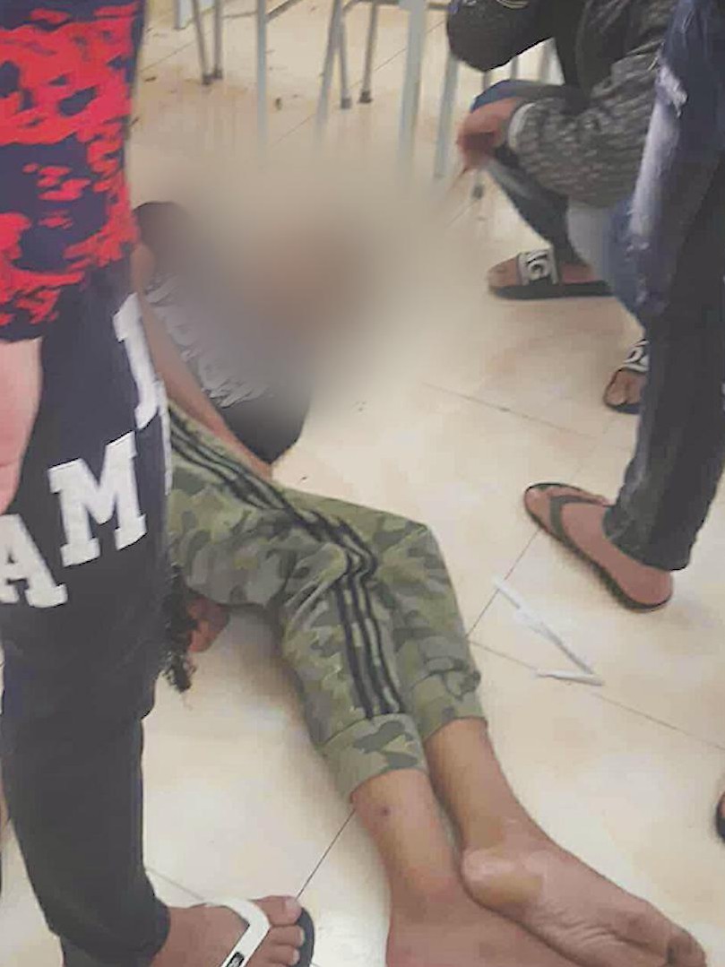 Thanh Hóa: Một nam sinh trường cao đẳng nghề bị đánh hội đồng nguy kịch