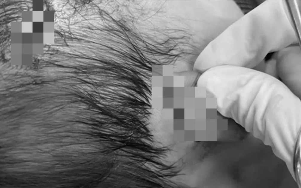 Bé gái 19 tháng tuổi ở Huế bị chó cắn nhiều vết thương nặng vùng đầu, mặt