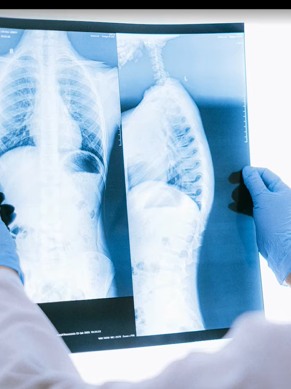 HTV Chiến thắng ung thư: Chụp X-quang, CT có gây ung thư không?