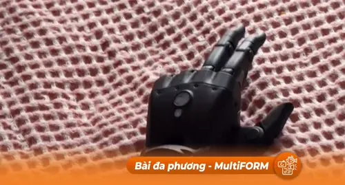 Anh: Bàn tay giả điều khiển từ xa