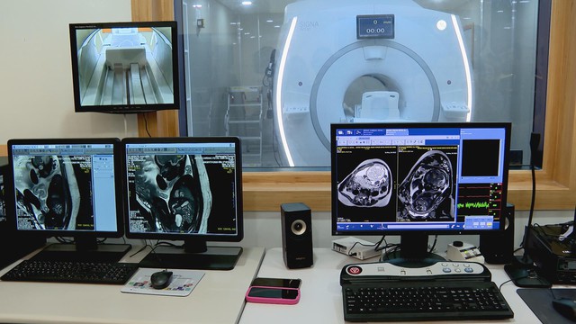 Bệnh viện Từ Dũ khánh thành Trung tâm MRI 3.0 Tesla và Khu Hồi sức – Cấp cứu hiện đại - Ảnh 4.