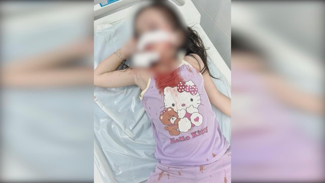 Thời sự HTV ngày 12/12/2025 | Hiểm họa từ chó thả rông - Ảnh 1.