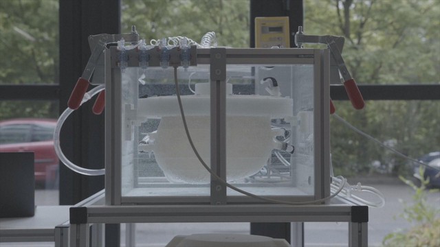 Hà Lan: Phát triển tử cung nhân tạo - Ảnh 1.