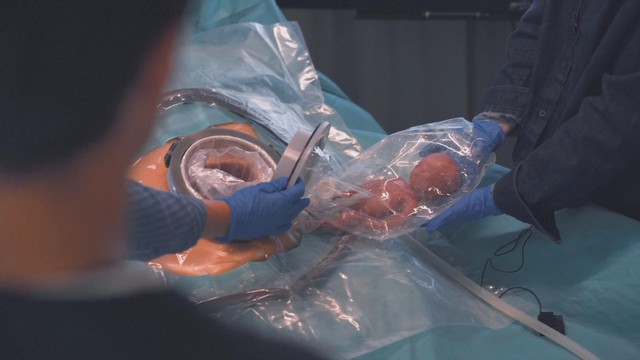 Hà Lan: Phát triển tử cung nhân tạo - Ảnh 2.