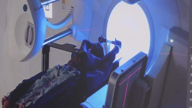 Kết hợp hóa xạ trị tiêu diệt khối u phổi ở người đàn ông hút thuốc lào hơn 30 năm - Ảnh 4.