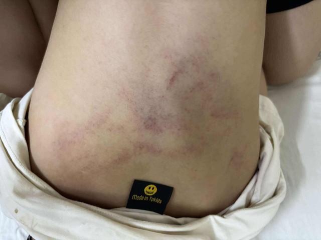 Bé gái bị đánh, kéo lê ở trường mầm non Hà Nội: Tạm đình chỉ giáo viên chứng kiến nhưng mặc kệ Tiến Dũng - Ảnh 1.
