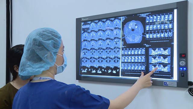 Niềng răng để đẹp, đừng để... “trả giá” vì nhầm chỗ - Ảnh 4.