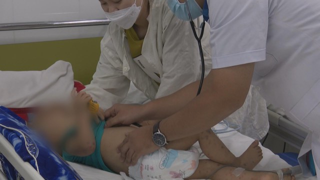 60 Giây 4/4/2026 | Khánh Hòa: Cảnh báo gia tăng các ca bệnh tay chân miệng ở trẻ nhỏ  - Ảnh 1.