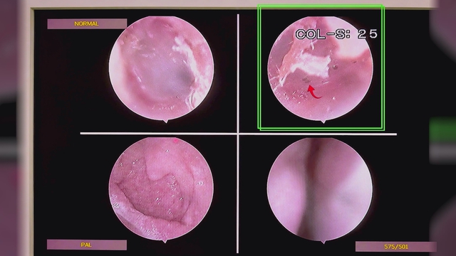 60 Giây ngày 9/6/2026 | Mưa lớn gây sạt lở tại nhiều địa phương miền Bắc - Ảnh 6.