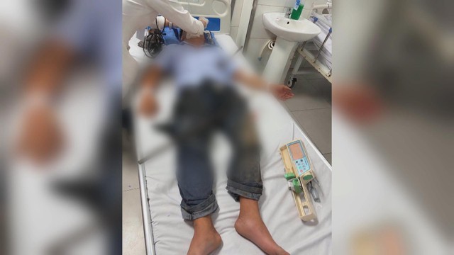 Cấp cứu một người đàn ông bị 2 thanh sắt đâm xuyên qua đùi và bụng | 60 Giây Sáng ngày /9/2026 - Ảnh 5.