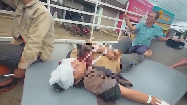 Lâm Đồng: Kịp thời đưa người dân bị bồn nước rơi trúng đầu đi cấp cứu- Ảnh 3.