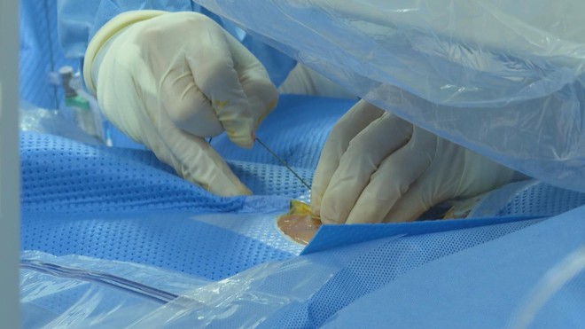 Đột phá trong can thiệp tim mạch phức tạp- Ảnh 5. Đột phá trong can thiệp tim mạch phức tạp- Ảnh 5.