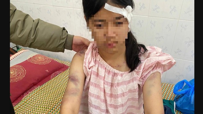 60 Giây ngày 22/11/2025 I Truy tố nhóm người khiêng quan tài diễu phố để quay TikTok tại TP. Hồ Chí Minh - Ảnh 8.