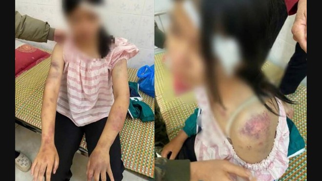 60 Giây ngày 22/11/2025 I Truy tố nhóm người khiêng quan tài diễu phố để quay TikTok tại TP. Hồ Chí Minh - Ảnh 9.