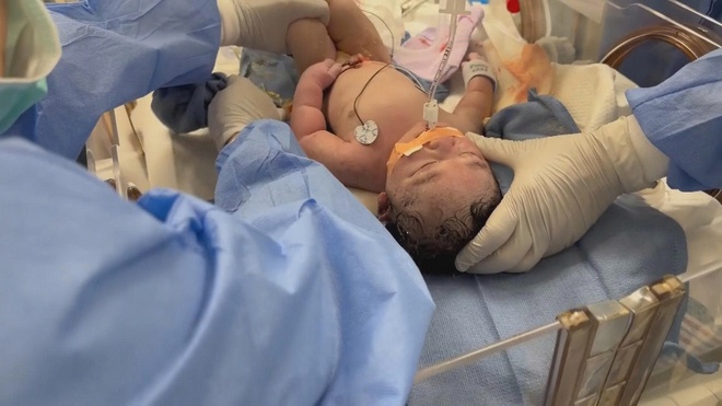 Mỹ: Xử lý thành công ca thai ngoài tử cung bị khối u 10kg chèn ép- Ảnh 1.