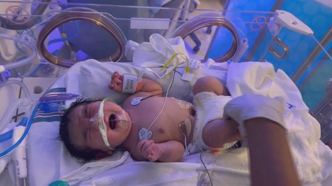 Mỹ: Xử lý thành công ca thai ngoài tử cung bị khối u 10kg chèn ép- Ảnh 2.