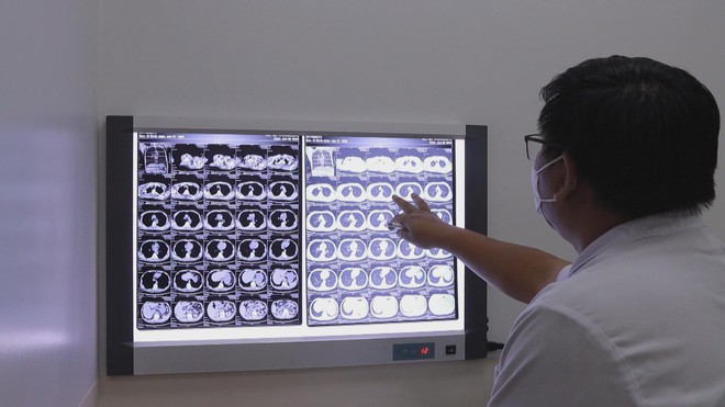 Đồng bộ hệ thống y tế - Hướng tới công bằng trong chăm sóc sức khỏe Nhân dân - Ảnh 7.