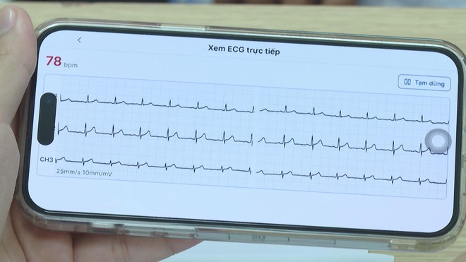 Ứng dụng A.I: "Trợ lý" đắc lực nâng tầm chất lượng y tế TP. Hồ Chí Minh - Ảnh 2.