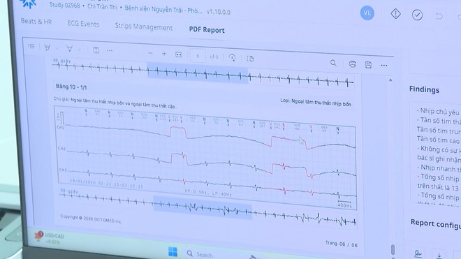 Ứng dụng A.I: "Trợ lý" đắc lực nâng tầm chất lượng y tế TP. Hồ Chí Minh - Ảnh 3.