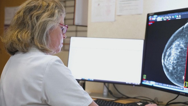 Thụy Điển nghiên cứu dùng A.I. cải thiện sàng lọc ung thư vú - Ảnh 3.