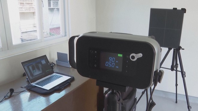 Philippines tích hợp trí tuệ nhân tạo nhận diện bệnh lao - Ảnh 3.