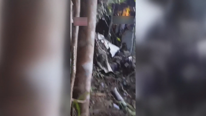 Thời sự trưa HTV ngày 17/4/2026 | Ba bệnh nhân đột quỵ cùng ngày được điều trị thành công bằng tiêu sợi huyết - Ảnh 6.