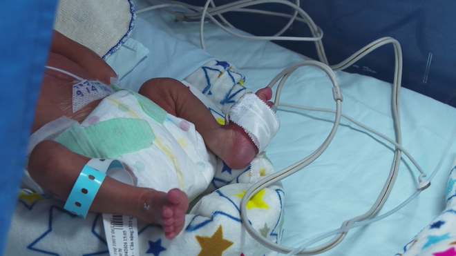 Tích cực nuôi sống trẻ sinh non trong bối cảnh dân số thấp - Ảnh 2.