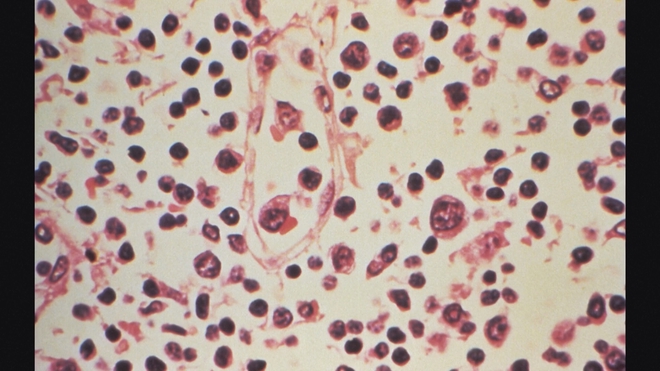 Các nước triển khai nhiều biện pháp kiểm soát dịch bệnh do virus Hanta - Ảnh 6.