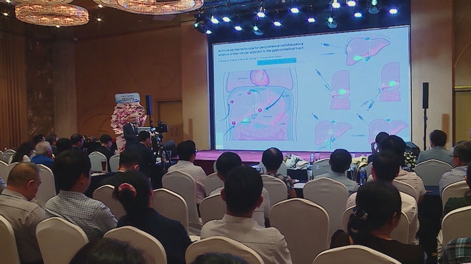 Thời sự trưa HTV ngày 14/6/2026 | Cập nhật những tiến bộ điều trị đa mô thức ung thư gan- Ảnh 1. Thời sự trưa HTV ngày 14/6/2026 | Cập nhật những tiến bộ điều trị đa mô thức ung thư gan- Ảnh 1.
