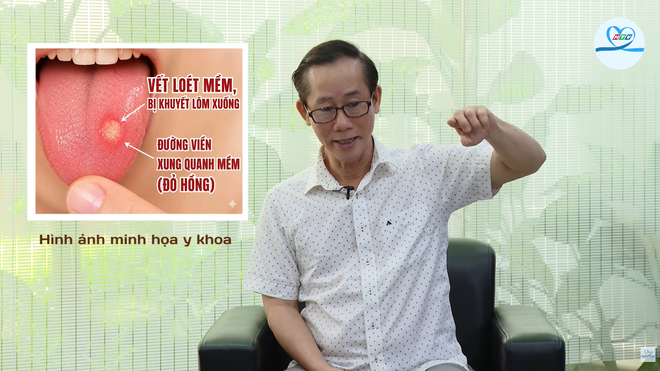 HTV Chiến thắng ung thư: Ung thư lưỡi dễ nhầm với nhiệt miệng - Ảnh 2.