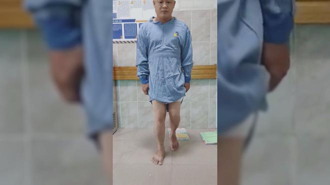 Thời sự trưa HTV ngày 3/8/2026 | Giải pháp phục hồi khả năng đi lại cho bệnh nhân hoại tử xương đùi - Ảnh 2.