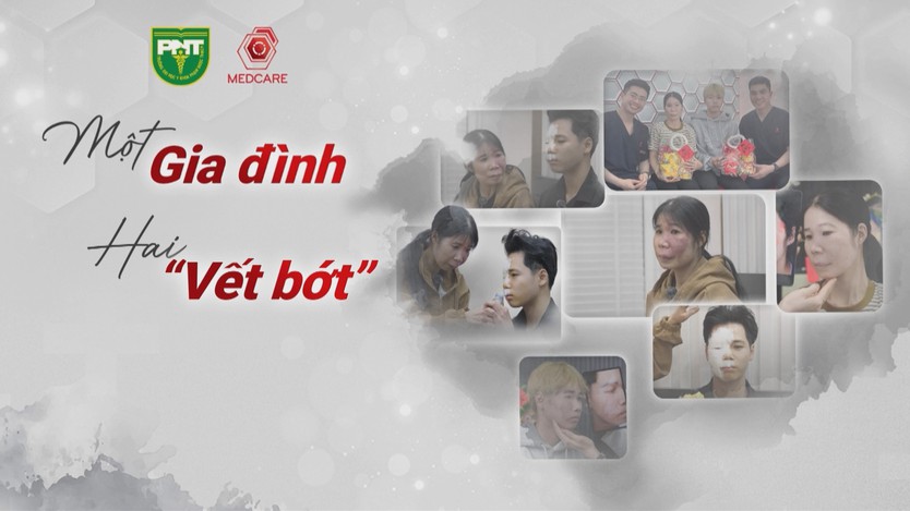Chấm dứt kỳ thị bạch biến: Nâng tầm điều trị  - Ảnh 2.