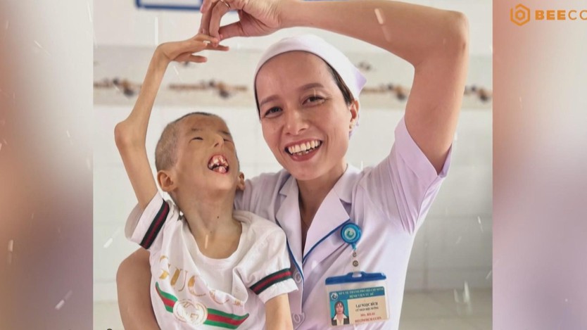 Làng Hòa Bình - Nơi ươm mầm nghị lực và lan tỏa yêu thương - Ảnh 11.