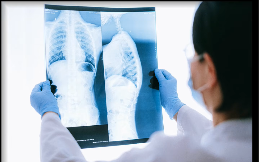 Polyp có nguy cơ thành ung thư? | HTV Chiến thắng ung thư - Ảnh 10.