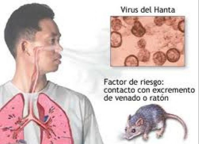 Bộ Y tế lên tiếng về virus Hanta sau chùm ca tử vong trên tàu du lịch nước ngoài- Ảnh 1.