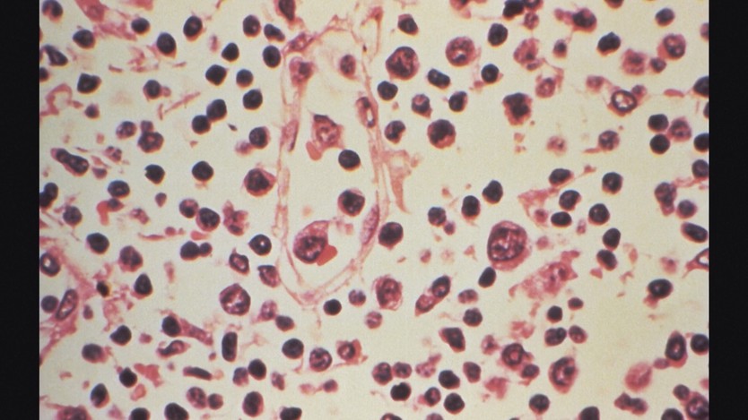 Các nước triển khai nhiều biện pháp kiểm soát dịch bệnh do virus Hanta - Ảnh 6.