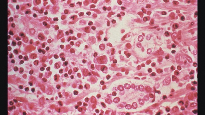 Các nước triển khai nhiều biện pháp kiểm soát dịch bệnh do virus Hanta - Ảnh 5.
