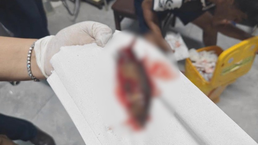 60 Giây Trưa ngày 27/6/2026 | Hy hữu cá rô còn sống chui vào họng người đàn ông - Ảnh 1.
