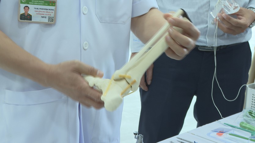 Bệnh viện Quân y 175 thị phạm mổ nội soi cổ chân với "đường mổ sâu vài milimet" - Ảnh 6.