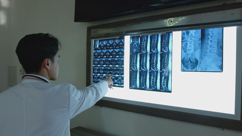 Cảnh báo trẻ hóa thoát vị đĩa đệm: Bé gái 13 tuổi phải phẫu thuật- Ảnh 1.