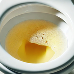 Dấu hiệu liên quan đến nước tiểu cảnh báo ung thư thận