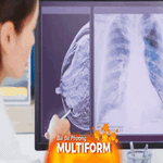 Nâng cao nhận thức - Chủ động khám tầm soát: Chìa khóa để ngăn ngừa tỉ lệ mắc bệnh ung thư vú hiện nay
