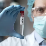 Nhiều nước tham gia đường đua nghiên cứu vaccine Ebola