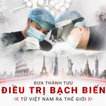 Bước tiến mới trong nghiên cứu và điều trị bạch biến