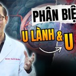 HTV Chiến thắng ung thư: Phân biệt u lành tính và u ác tính