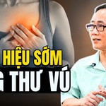 HTV Chiến thắng ung thư: Dấu hiệu ung thư vú giai đoạn sớm