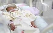 Bé gái Hàn Quốc sinh non chỉ nặng 328 gram, 6 tháng sau nặng 4kg