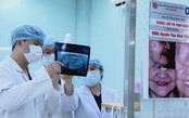 Từ thói quen ăn uống đến nguy cơ ê buốt răng