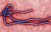 Bộ Y tế tăng cường giám sát trước nguy cơ dịch Ebola