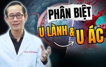 HTV Chiến thắng ung thư: Phân biệt u lành tính và u ác tính